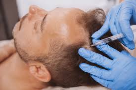 PRP (Platelet-Rich Plasma) Therapy