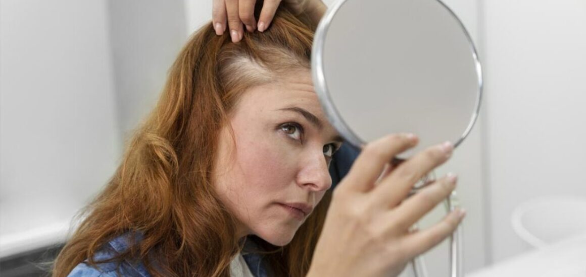 Hair Loss & Baldness Treatment