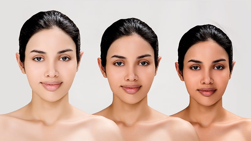 Skin Whitening (Up to 3 Shades Lighter)